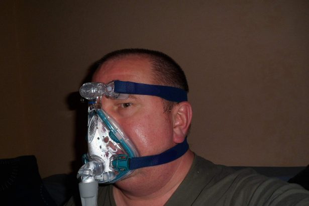 Equipment used in the treatment of obstructive sleep apnoea