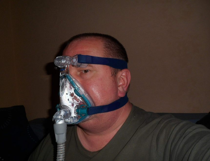 Equipment used in the treatment of obstructive sleep apnoea